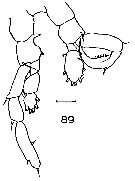 Espèce Lucicutia macrocera - Planche 13 de figures morphologiques