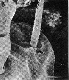 Espce Metacalanus sp.2 - Planche 4 de figures morphologiques