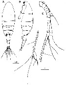 Espèce Paraeuchaeta elongata - Planche 17 de figures morphologiques