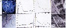 Espèce Copilia mirabilis - Planche 19 de figures morphologiques