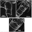 Espèce Acartia (Odontacartia) edentata - Planche 6 de figures morphologiques
