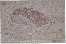 Espce Monstrilla sp.2 - Planche 3 de figures morphologiques