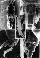 Espèce Candacia cheirura - Planche 7 de figures morphologiques