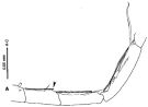 Espèce Tortanus (Acutanus) angularis - Planche 5 de figures morphologiques