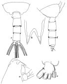 Espèce Scottocalanus helenae - Planche 11 de figures morphologiques