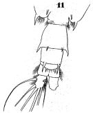 Espèce Acartia (Odontacartia) spinicauda - Planche 1 de figures morphologiques