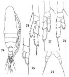 Espèce Calocalanus gracilis - Planche 2 de figures morphologiques