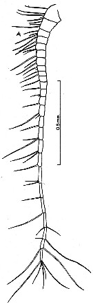 Espèce Acrocalanus andersoni - Planche 4 de figures morphologiques