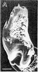 Espèce Calanus sinicus - Planche 15 de figures morphologiques