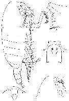 Espce Cornucalanus robustus - Planche 3 de figures morphologiques