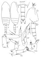 Espèce Aetideopsis retusa - Planche 2 de figures morphologiques