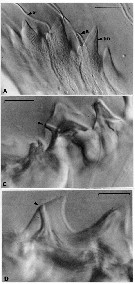 Espèce Neocalanus cristatus - Planche 5 de figures morphologiques