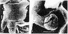 Espèce Pteriacartia josephinae - Planche 2 de figures morphologiques