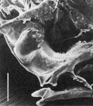 Sructure Intermaxillipedale à la base inférieure du cadre buccal, munie de puissantes épines (à gauche) chez Platycopia inornata (Platycopioida)